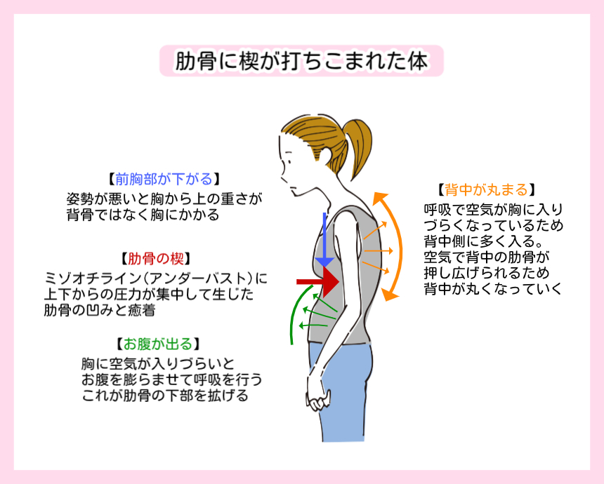 肋骨に楔（くさび）が打ち込まれた体のメカニズム解説図。悪い姿勢により胸部が下がり、ミゾオチラインに圧力が集中して肋骨の凹みと癒着（楔）が生じている様子。その影響で呼吸の空気が背中側に回り背中が丸まる（猫背）プロセスや、お腹を膨らませる呼吸によって肋骨下部が押し広げられ「リブフレア」が形成される仕組みをイラストで説明しています。
