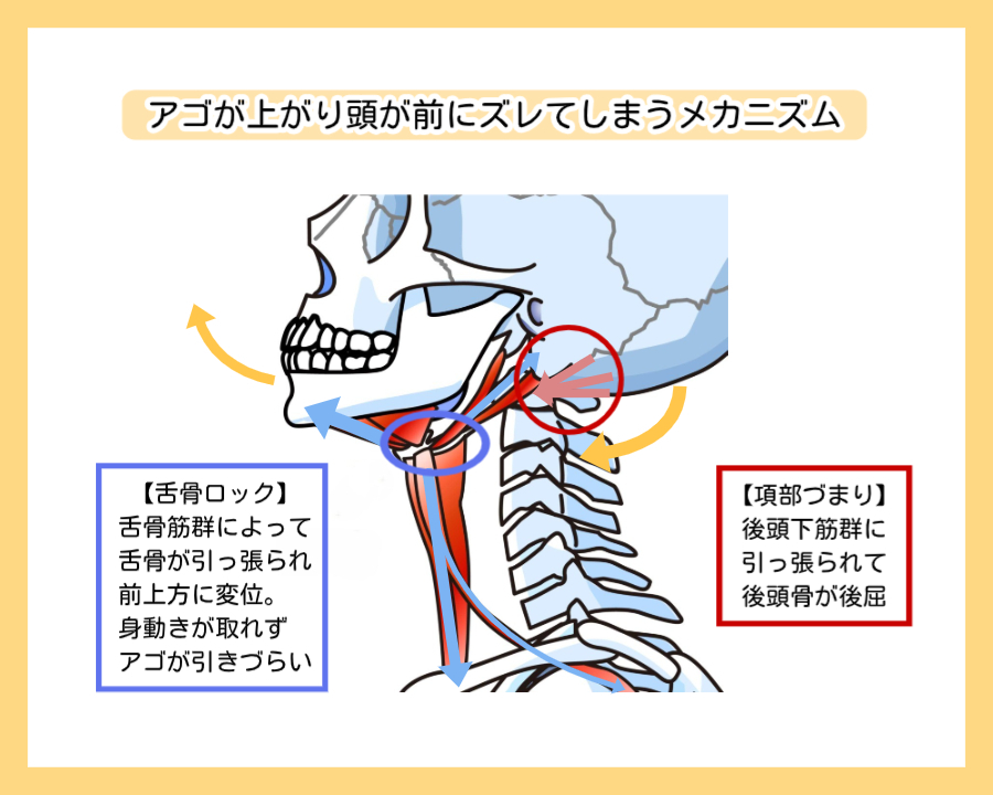 頭部前位のメカニズム