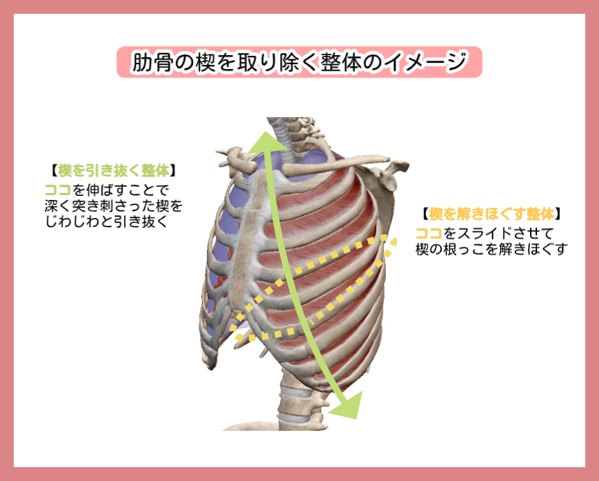 肋骨の楔を取り除く整体のイメージ図。解剖学的な胸郭モデルを用い、2つの手技を解説しています。左側には「楔を引き抜く整体」として、呼吸に合わせて肋骨を上下に伸ばしスペースを拡げる動きを緑の矢印で表示。右側には「楔を解きほぐす整体」として、癒着したミゾオチライン（楔の根っこ）を横方向にスライドさせて柔軟性を引き出す動きを黄色の点線で示しています。