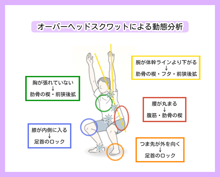オーバーヘッドスクワットによる動態分析の図解。腕の下がりは肋骨の楔、胸が張れないのは前狭後拡、腰が丸まるのは腹筋の硬さ、膝の内入りやつま先の外向きは足首のロックが原因であることを示す、スポーツ整体の診断イメージ。