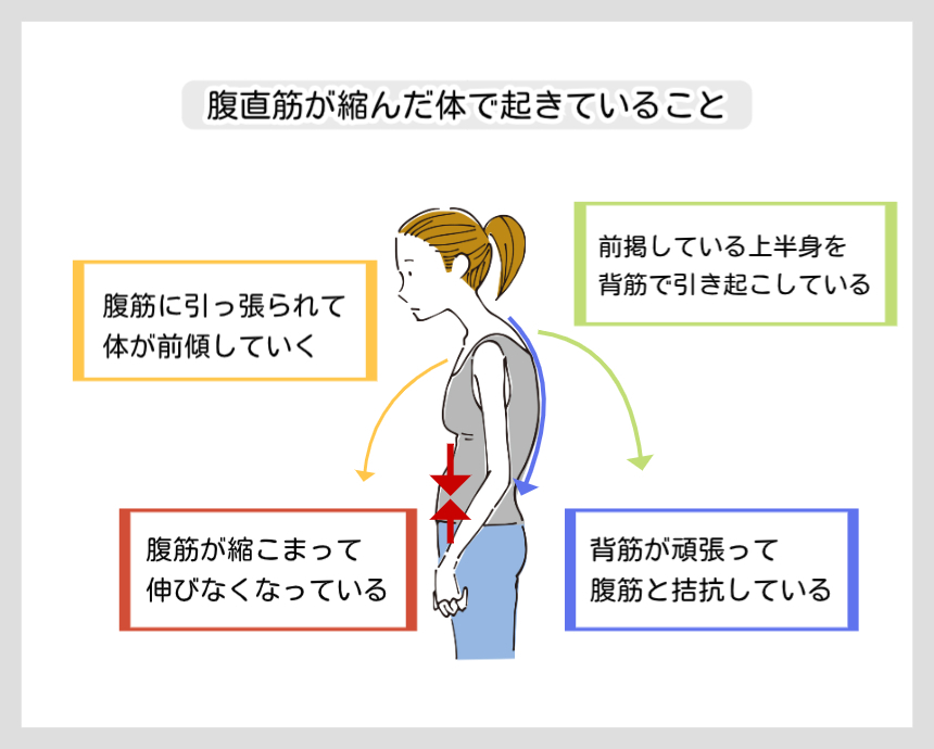 腹直筋が縮んだ体で起きていることの図解。腹筋が縮んで伸びなくなることで体が前傾し、それと拮抗しようとして背筋が頑張りすぎることで猫背や背中の張りが起きる仕組みを説明するイラスト。