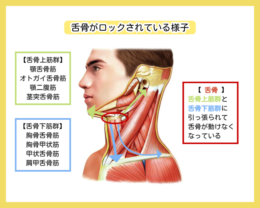 舌骨ロックのメカニズム解剖図