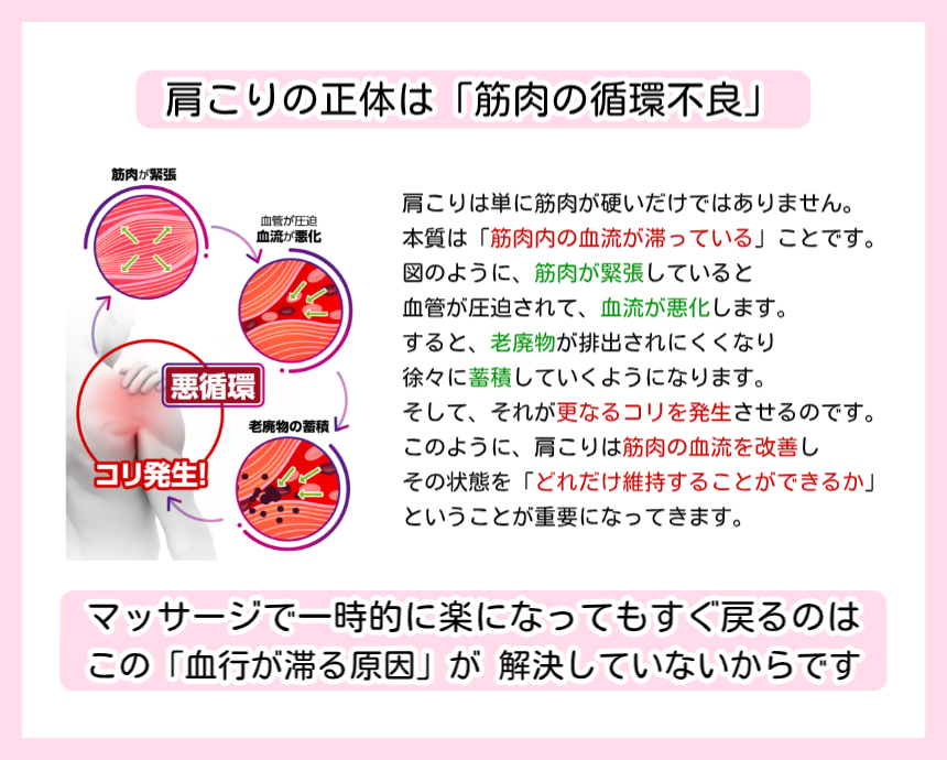 【神楽坂整体たいむ】肩こりの原因図解：筋肉の緊張による血行不良と老廃物の蓄積。マッサージで根本改善しない理由を解説。