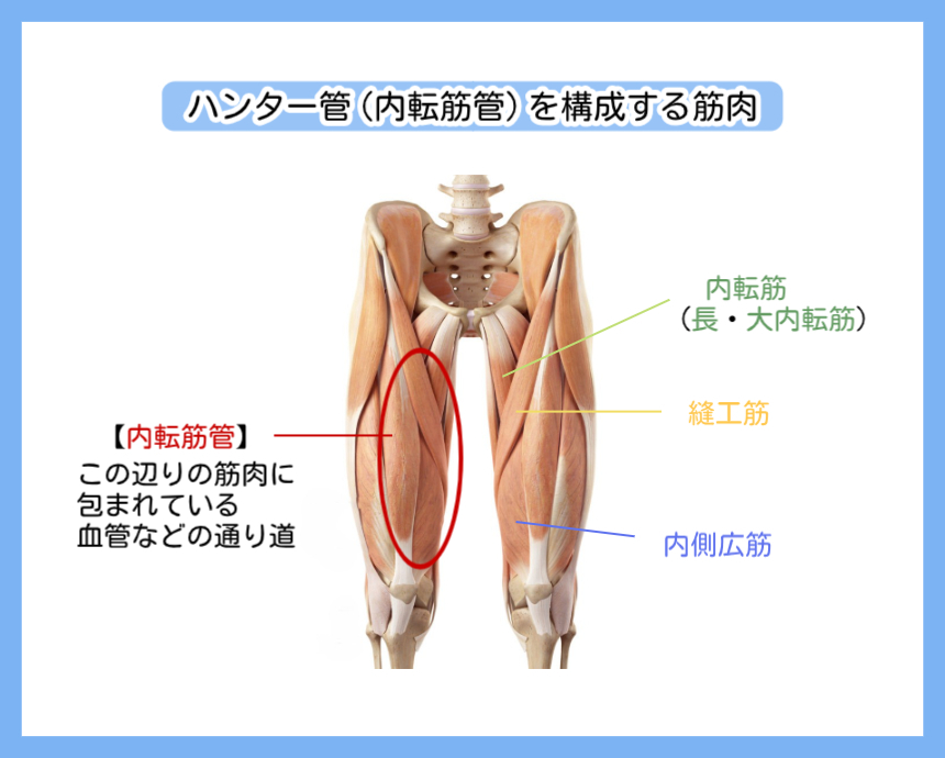 ハンター管（内転筋管）を構成する筋肉の解説図。内転筋（長・大内転筋）、縫工筋、内側広筋に包まれた血管などの通り道を示したイラスト。