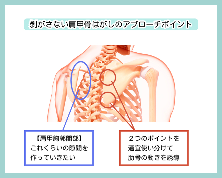 剥がさない肩甲骨はがしのアプローチポイント。肩甲骨上の2つのポイントを適切に押さえて肋骨の動きを誘導し、理想的な「肩甲胸郭間部」の隙間を作っていく施術イメージの図解。