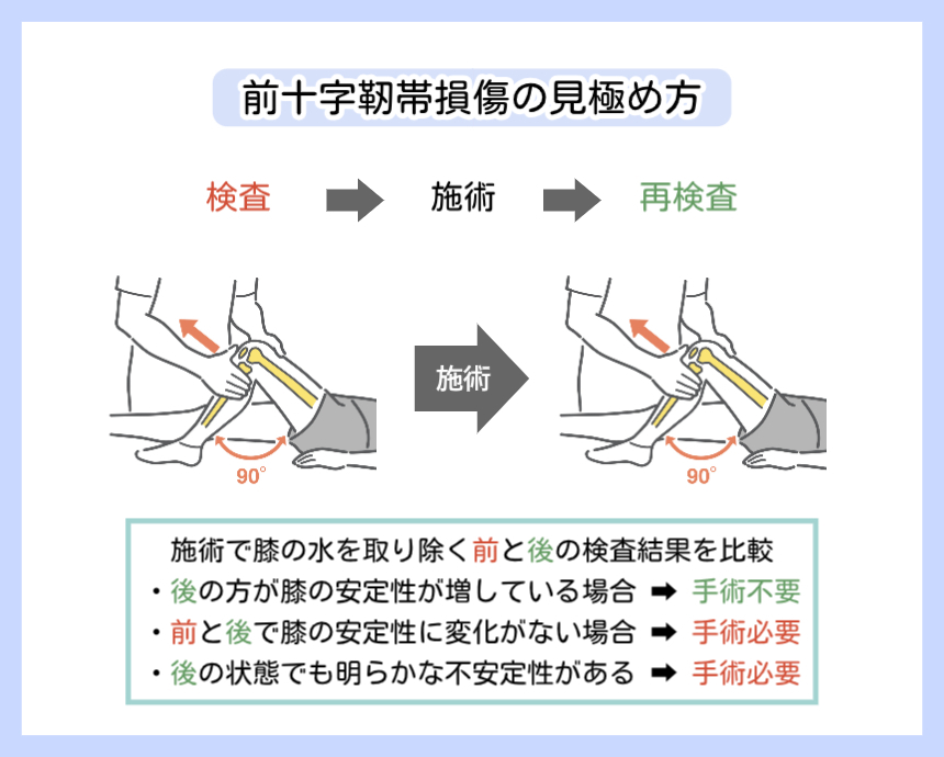 前十字靭帯損傷の前方引出し検査の流れ