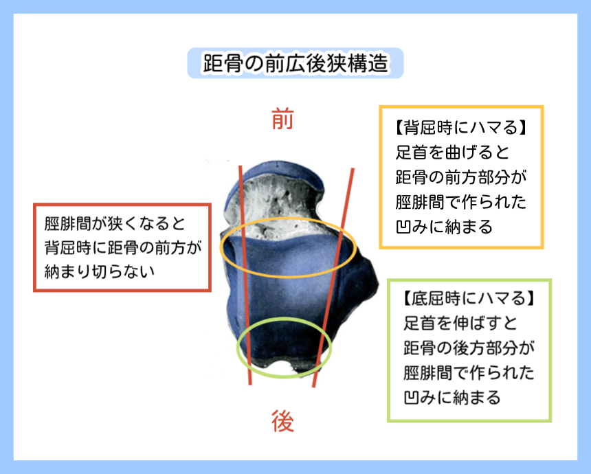 距骨の前広後狭構造（前方部が広く後方部が狭い）を示し、背屈時に前方部が脛腓間に収まる仕組みと、隙間が狭いと収まりきらない様子を解説した図。