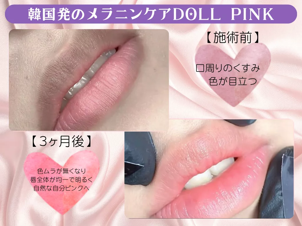 ブログアイコン