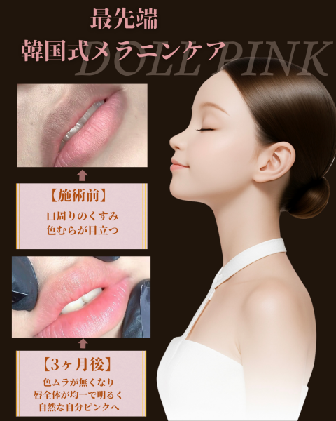 ドールピンク製品