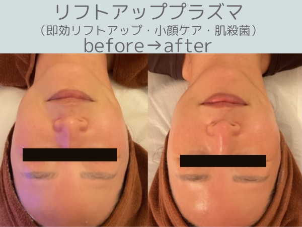 ビフォーアフター2